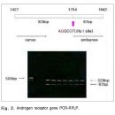 안드로겐 탈모증 환자에서 제한효소 Stu l에 대한 안드로겐 수용체 유전자의 다형성 연구 이미지