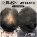 디블랙 | 진주두피 탈모 성지 디블랙 아카데미 후기