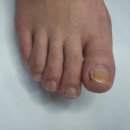 레푸스 감삼점&에이레네 이미지