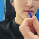 세림의원 | 신사역입술필러 CSC로렌의원 악마입꼬리 통증 가격 일주일후기