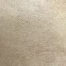 아토엠디 | 런닝 수영 후 피부건조증, 에스트라 아토베리어 잇칭 크림 엠디 처방 후기