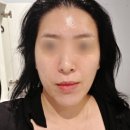 가인 - 강서구 | 부천 경락 얼굴축소 데콜테 관리 잘하는 가인미가 후기