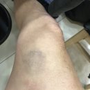 제이준핏 이미지