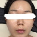 피오니스킨앤바디 | [부산/연제구] 피오니스킨앤바디 방문후기 연산동피부관리 연산동에스테틱 연산동미백관리 추천