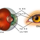 눈동자로 알수있는 우리몸의병 이미지