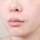 시호와 | 좁쌀여드름 이마여드름 턱여드름 루틴 플라닉프로 모공디바이스 파티온 노스카나인 야노시호 유리광채 후기