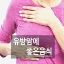 유방암 수술후 회복에 좋은 음식 챙겨주세요 이미지