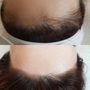 예헤어 이미지