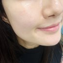 포커스 온 팩