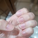 에이에이네일 이미지