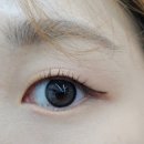 아이씨유비전케어 이미지