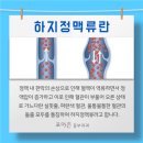 하지정맥예방 가벼운 스트레칭부터 이미지