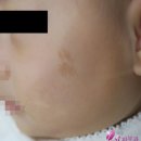 세종퍼스트피부과 이미지