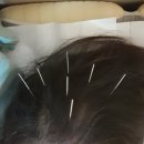 압구정연한의원 이미지