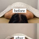 고연 | 운정피부관리 고연에스테틱에서 RSPT 받고 어깨라인 완전 달라진 후기