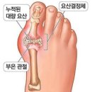 Re:중요자료) DNA, RNA 염기코드 복제를 위한 단백질 분해와 합성고문으로 나타나는 신체증상. 핵산 및 나트륨 부족, 요산 증가 이미지