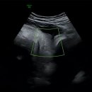 태림약국 | 37주 0일차 | 초산 유도분만 성공편 | 3.41kg 크롱이 탄생 👶🏻 | 자연분만 생생후기…