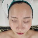 장유피부관리 고운피부바디샵 유산균테라피 받은 후기