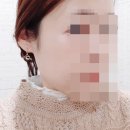 국민앰플 레스베라트롤앰플 쁘띠쁘띠 사용후기