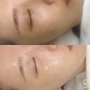 용인 기흥피부관리 에스테틱 베누아 세멘부스팅먼트 후기