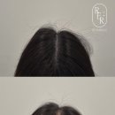 로잉헤어 티스토리