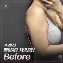 최신외과의원 네이버블로그