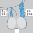 남성의 약 15%에게서 발병한다는 고환 질환 이미지