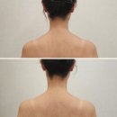 울산 삼산동 에스테틱 아뜰리에드스킨 제니어깨 라운드숄더 관리 받은 후기