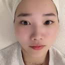 동구열관리