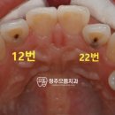청주으뜸치과 이미지