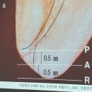 덴츠플라이시로나코리아(유) | [세미나] 덴츠플라이시로나 - 근관치료의 시작과 끝, 실전으로 연결하다 / 부산 / 장석우 교수