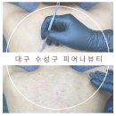 드림케어약국 | 대구 수성구 피어나뷰티 :: 등여드름 등드름 알라딘필링 후기 | 로즈드메르 필링
