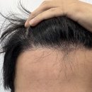 모디헤어플란트의원 이미지