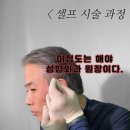 메이드미성형외과의원 | 원장님의 실루엣소프트 생생한 후기가 궁금하다면... (by 성형외과전문의) #실루엣소프트