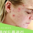 용테라피
