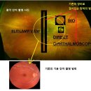 바른안과 이미지