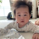 사시미래 | 5살 사시수술