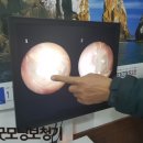 21세기박약국 | [영주보청기/봉화보청기] 63세 어머님 보청기 후기