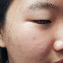 에스앤지코스메틱 | 던듀 씨드오일 마스크팩 자극없는 순면시트 보습 미백마스크팩