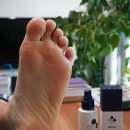 메디레스큐 | 오래된 발바닥 각질 무좀에 메디좀 풋케어