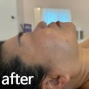 [김천부곡동피부관리 잘하는 곳] 김천에스테틱 디자인라인스튜디오 윤곽관리 후기