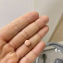 무척바른한방병원 네이버블로그