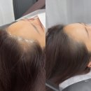 성수 두피문신 휴먼핸즈가 특별한 이유