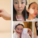 우노메디칼 이미지