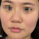 이천 피부 및 마사지 관리 어디? 맘앤바디미 맘&amp;바디미 추천 및 후기