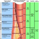 동맥경화증 이미지
