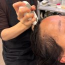 H-4 | 향남탈모 H.리셀 관리 방문4회차 후기