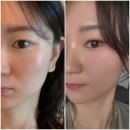 반포짐 방배 | 반포 방배 웨딩촬영 스냅 메이크업 , 라투메이크업 솔직후기