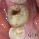 보일치과기공소 이미지