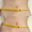 구미로144번길 | 분당복부독소관리 예비신부복부관리로 딱 좋은 올가드림뷰티 분당무지개마을점 후기 -주차,예약,효과